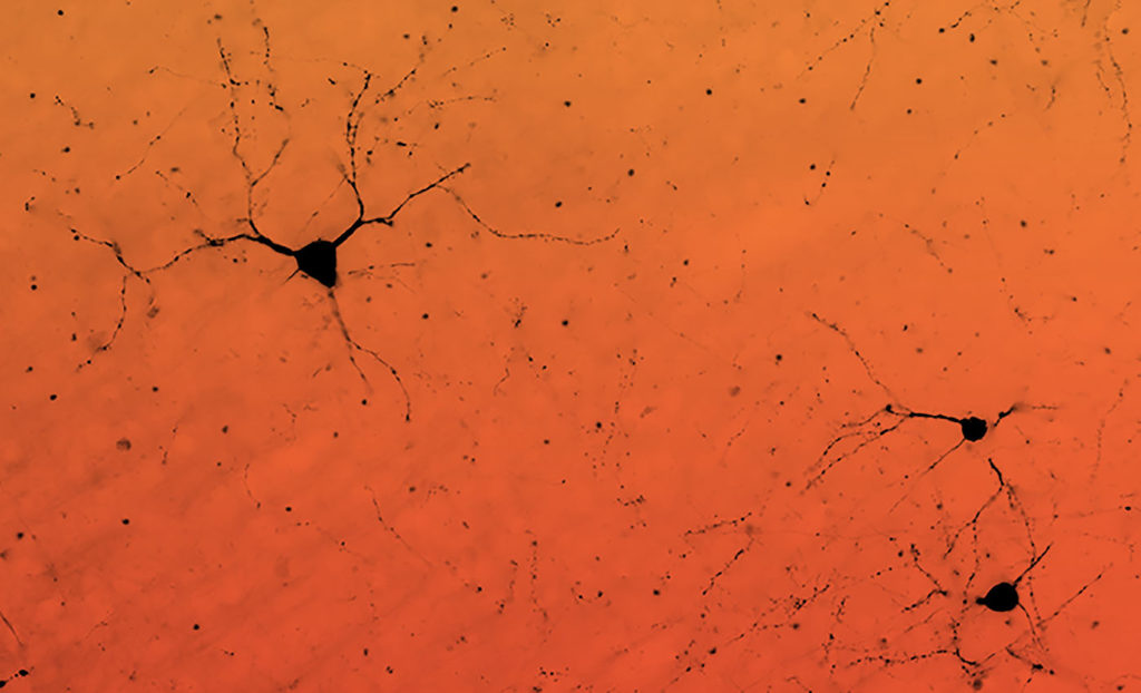 Neurons in the brain