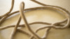 Humanitarian Health Lessons Learned: Ebola
